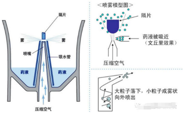 雾化吸入治疗经常做，而这些“雾区”里的“误区”，很多护士不知道